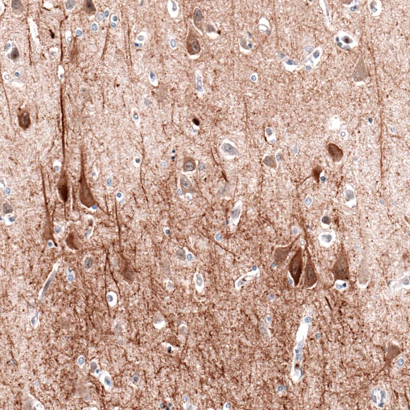 Immunohistochemistry-Paraffin: MAP2 Antibody (CL5420) [NBP3-52490]