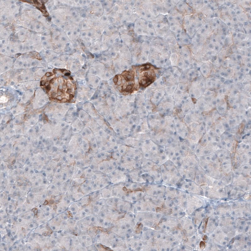 Immunohistochemistry-Paraffin: MAP2 Antibody (CL5420) [NBP3-52490]