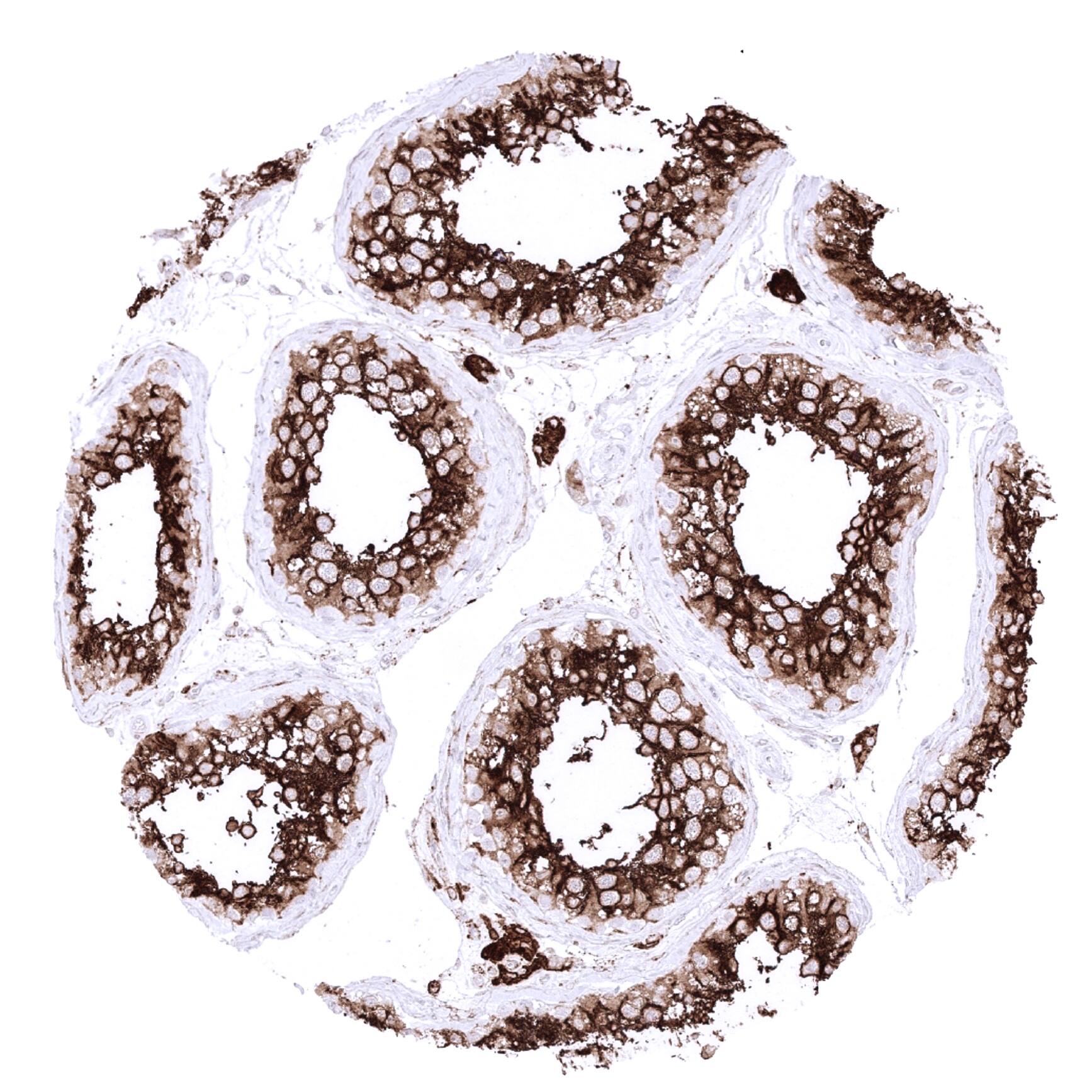 ACE-2 Antibody (MSVA-919R) Immunohistochemistry: ACE-2 Antibody (MSVA-919R) - Azide and BSA Free [NBP3-52492]