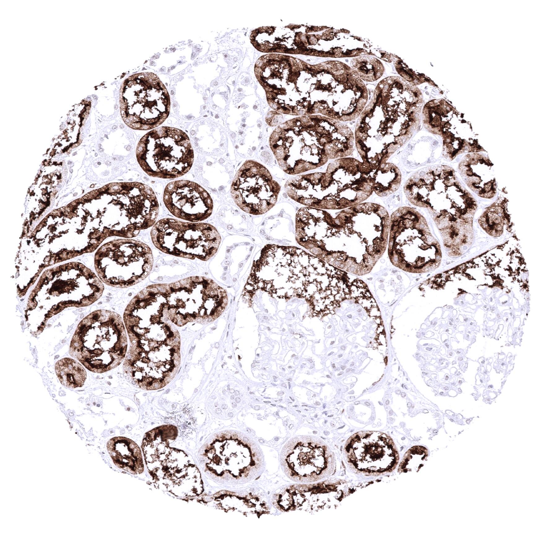 ACE-2 Antibody (MSVA-919R) Immunohistochemistry: ACE-2 Antibody (MSVA-919R) - Azide and BSA Free [NBP3-52492]