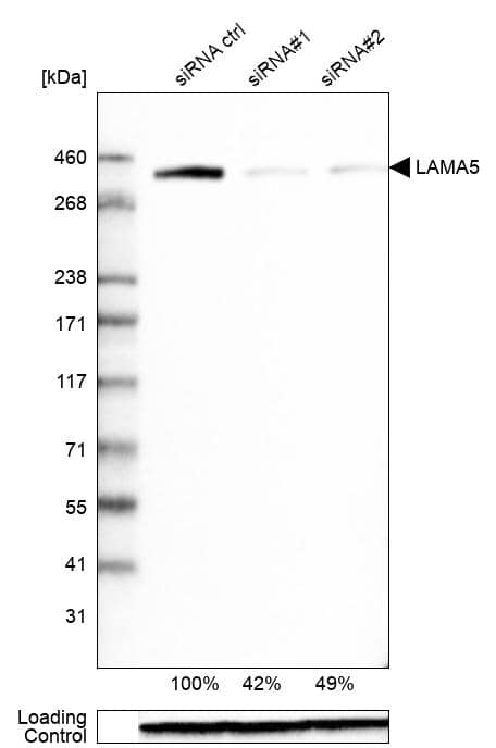 Laminin alpha 5 Antibody (CL3118) - BSA Free (NBP3-57813) by Novus ...