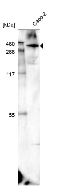 Laminin alpha 5 Antibody (CL3118) - BSA Free (NBP3-57813) by Novus ...