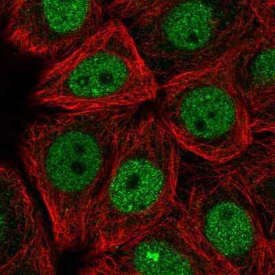 Immunocytochemistry/ Immunofluorescence: nef-associated protein 1 Antibody [NBP2-56680]