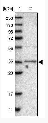 Western Blot: nef-associated protein 1 Antibody [NBP2-14424]