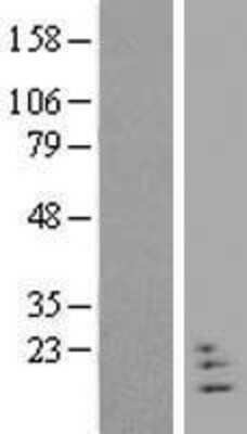 Western Blot: NRN1L Overexpression Lysate [NBP2-04700]