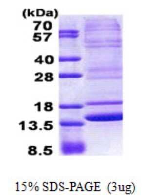 SDS-PAGE: Recombinant Human Neuromedin B His Protein [NBP2-23280]