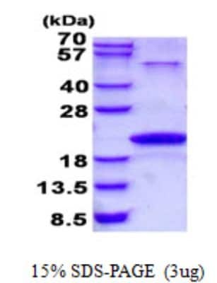 SDS-PAGE: Recombinant Human Neurotensin His Protein [NBP2-23282]