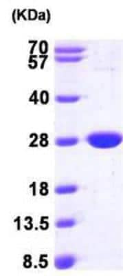 Western Blot: Recombinant E. coli nfnB His Protein [NBP1-46035]