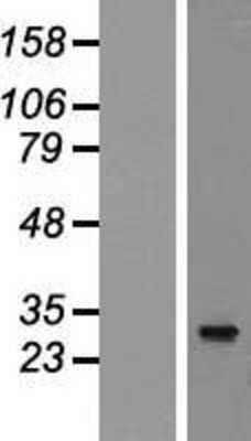 Western Blot: nkx6.2 Overexpression Lysate [NBP2-05030]