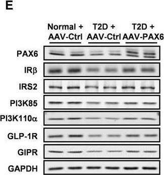 GLP-1R Antibody - BSA Free