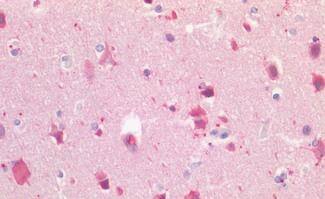 Lgr5/GPR49 Antibody - BSA Free