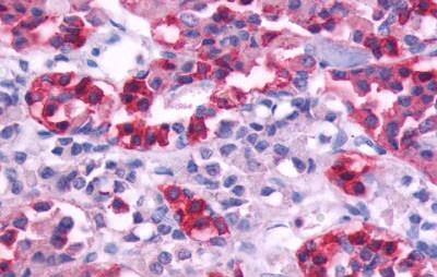 Muscarinic Acetylcholine Receptor M5/CHRM5 Antibody - BSA Free