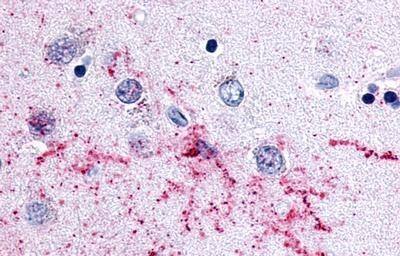 MCHR2 Antibody - BSA Free