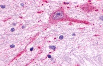 MCHR2 Antibody - BSA Free