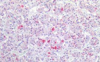 GnRHR Antibody - BSA Free