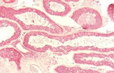 EMR1 Antibody - BSA Free