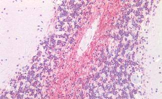 MRGX4 Antibody - BSA Free