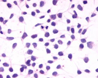Cannabinoid R1/CB1/CNR1 Antibody - BSA Free