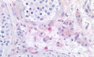 Histamine H4R Antibody - BSA Free