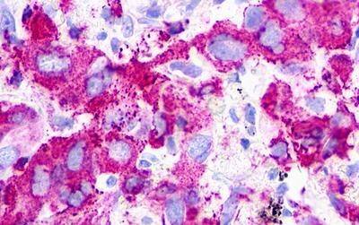 P2Y1/P2RY1 Antibody - BSA Free