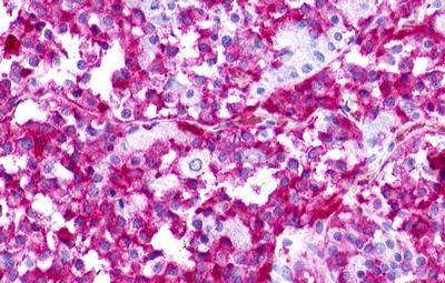 GPR176 Antibody - BSA Free