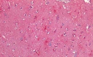 CRLR Antibody - BSA Free