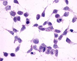 mGluR2 Antibody - BSA Free
