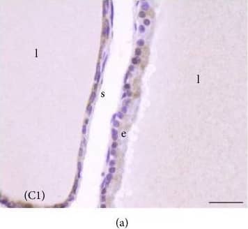 Melatonin Receptor 1B Antibody - BSA Free