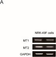 Melatonin Receptor 1B Antibody - BSA Free