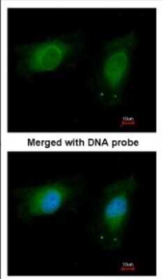 Immunocytochemistry/ Immunofluorescence: NM23-H1 Antibody [NBP2-19549]