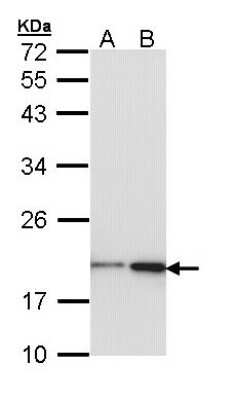 Western Blot: NM23-H1 Antibody [NBP2-19549]