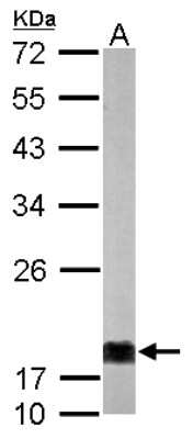 Western Blot: NM23-H1 Antibody [NBP2-19549]