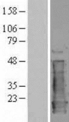 Western Blot: NM23-H1 Overexpression Lysate [NBP2-04154]