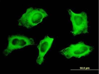 Immunocytochemistry/ Immunofluorescence: non-muscle Myosin IIA Antibody (1H6) [H00004627-M05]