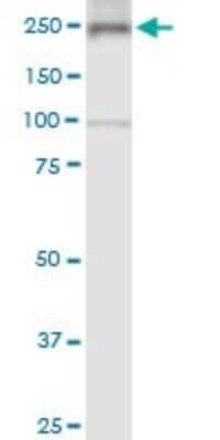 Western Blot: non-muscle Myosin IIA Antibody (2B3) [H00004627-M03]