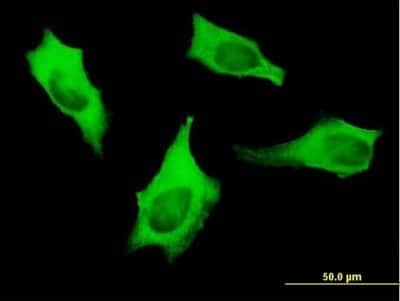 Immunocytochemistry/ Immunofluorescence: non-muscle Myosin IIA Antibody (4H3) [H00004627-M06]