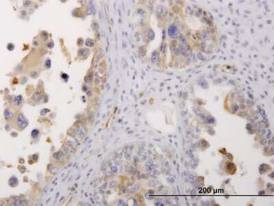Immunohistochemistry-Paraffin: non-muscle Myosin IIA Antibody (4H3) [H00004627-M06]