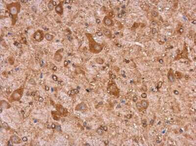 Immunohistochemistry-Paraffin: non-muscle Myosin IIA Antibody (GT218) [NBP3-13532]