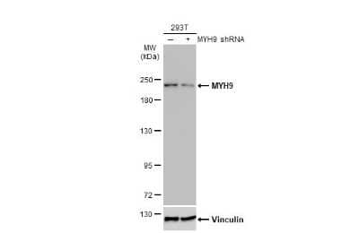 Western Blot: non-muscle Myosin IIA Antibody (GT218) [NBP3-13532]