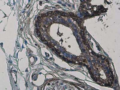 Immunohistochemistry-Paraffin: non-muscle Myosin IIA Antibody (GT566) [NBP3-13580]