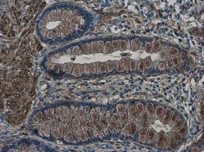 Immunohistochemistry-Paraffin: non-muscle Myosin IIA Antibody (GT566) [NBP3-13580]