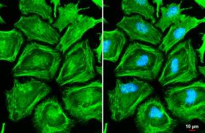 Immunocytochemistry/ Immunofluorescence: non-muscle Myosin IIA Antibody [NBP2-19563]