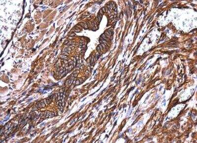 Immunohistochemistry-Paraffin: non-muscle Myosin IIA Antibody [NBP1-31733]