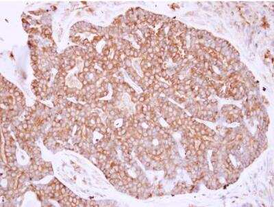 Immunohistochemistry-Paraffin: non-muscle Myosin IIA Antibody [NBP1-31733]