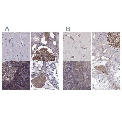 Immunohistochemistry-Paraffin: non-muscle Myosin IIA Antibody [NBP1-85244]