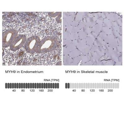 Immunohistochemistry-Paraffin: non-muscle Myosin IIA Antibody [NBP1-85244]