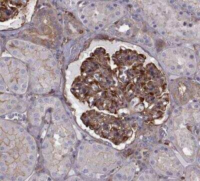 Immunohistochemistry-Paraffin: non-muscle Myosin IIA Antibody [NBP1-85244]