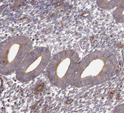 Immunohistochemistry-Paraffin: non-muscle Myosin IIA Antibody [NBP1-85244]