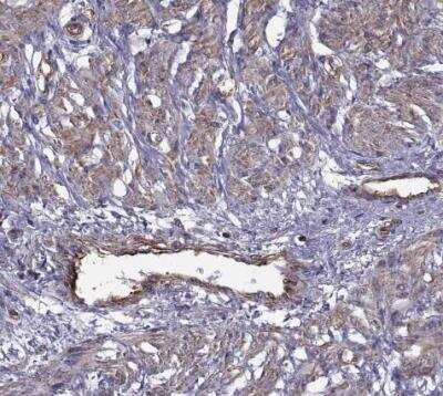 Immunohistochemistry-Paraffin: non-muscle Myosin IIA Antibody [NBP1-85244]