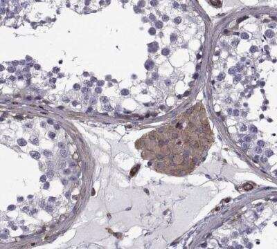 Immunohistochemistry-Paraffin: non-muscle Myosin IIA Antibody [NBP1-85244]